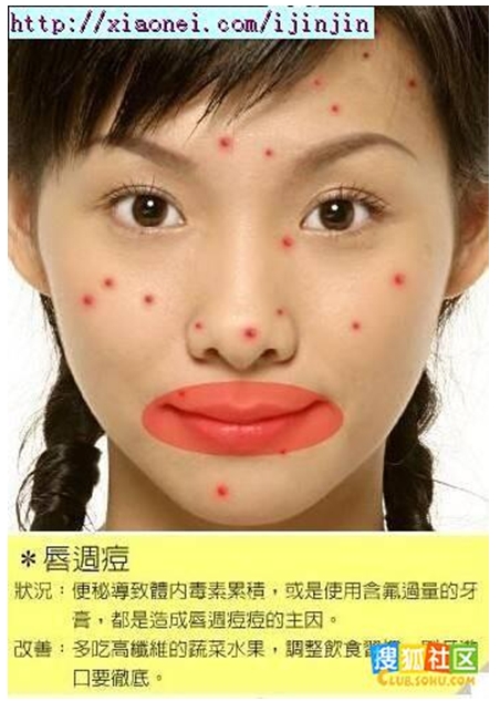唇週痘 唇週痘