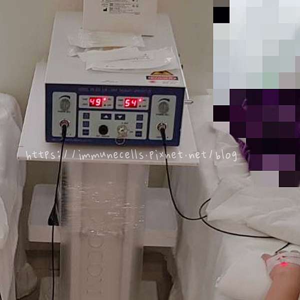 預防醫學 靜脈雷射是什麼 Ilib 氦氖雷射價格 靜脈雷射對糖尿病患者有效 免疫細胞資訊分享 愛有醫療小筆記 痞客邦 預防醫學 靜脈雷射是什麼 Ilib 氦氖雷射價格 靜脈雷射對糖尿病患者有效 免疫細胞資訊分享 愛有醫療小筆記 痞客邦
