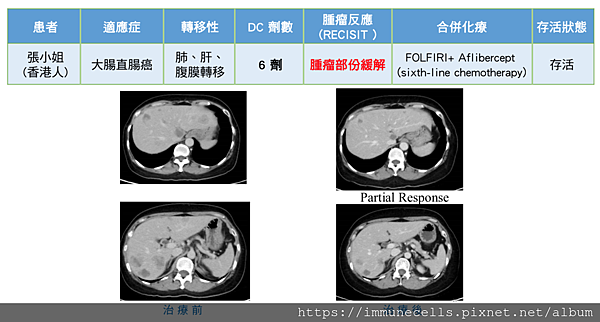 dc細胞治療