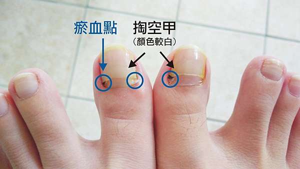 推 問題甲的救星 妃愛美甲salon I M 王小昕 痞客邦