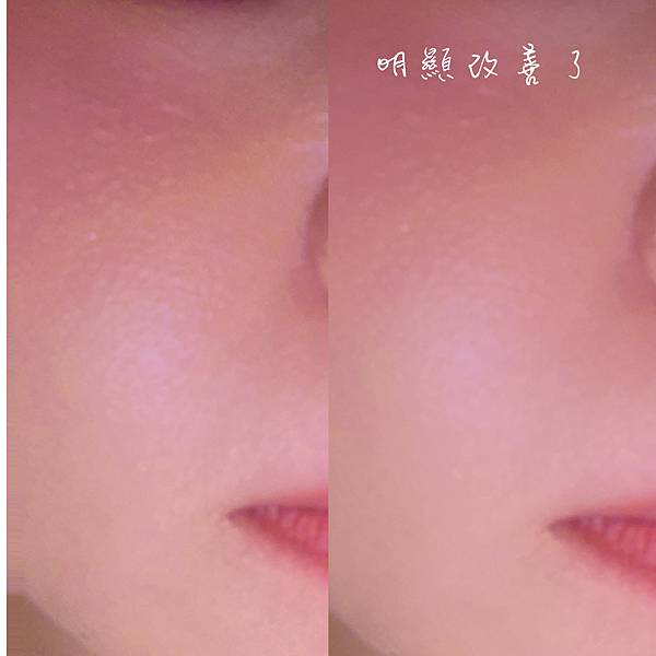 【臉部保養】親愛的我把毛孔變小了!毛孔粗大救星-【Lead 【臉部保養】親愛的我把毛孔變小了!毛孔粗大救星-【Lead