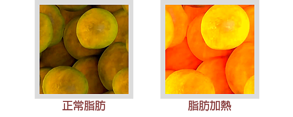 脂肪上圖.png 脂肪上圖.png
