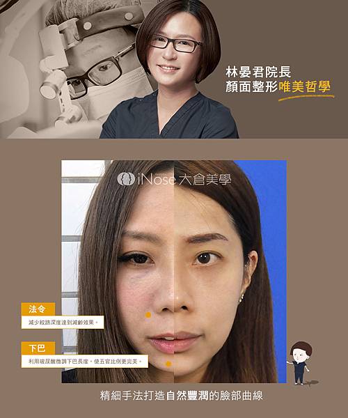 隆鼻玻尿酸 (4).jpg 隆鼻玻尿酸 (4).jpg