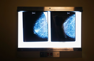 mammography.jpg