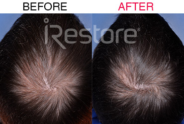 42歲男性(使用6個月)