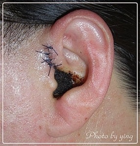 補耳膜 Ying的生活誌 痞客邦