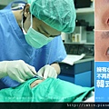 雙眼皮手術coverstory