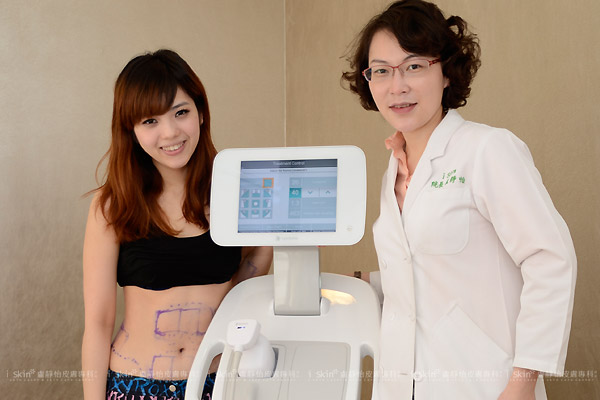 立塑超音波溶脂11