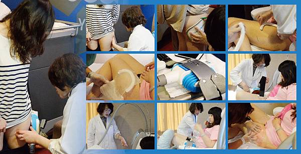 o-CoolSculpting2-01 o-CoolSculpting2-01