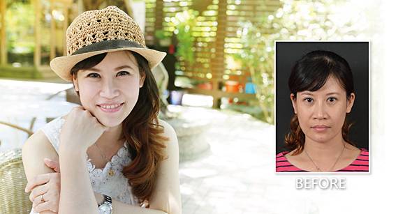 Peng Hua Ulta V-lifting3