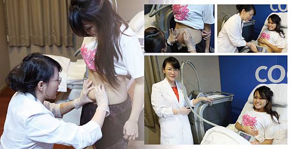 Coolsculpting-Qin Zhu Lin3