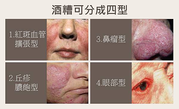 Physicians Box-Dermatitis-5 Physicians Box-Dermatitis-5