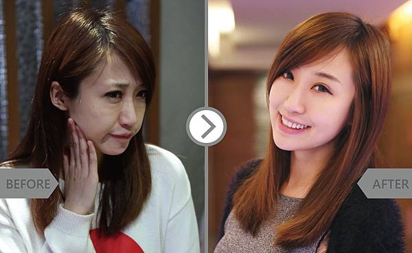 Botox+doublo-Tasha2 Botox+doublo-Tasha2