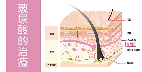 Lu-Doctor-Wrinkle-3 Lu-Doctor-Wrinkle-3