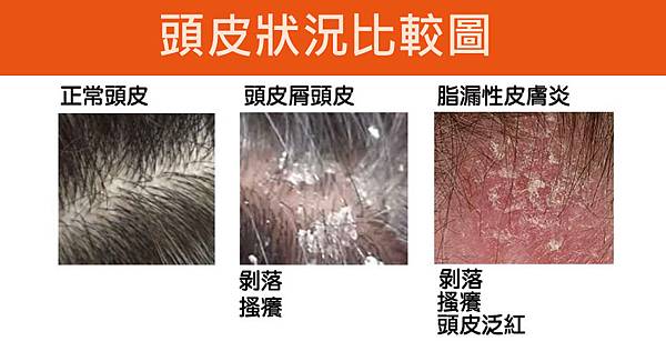 Huang-Doctor-Seborrheic-2 Huang-Doctor-Seborrheic-2