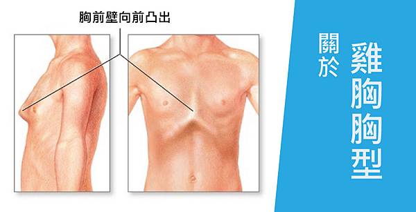 Wu-Doctor-Breast-2 Wu-Doctor-Breast-2