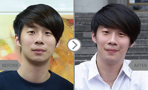 Correction_nose-lin-2 Correction_nose-lin-2