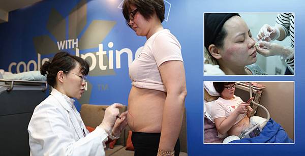 Hyaluronic+CoolSculpting-Vanessa-3 Hyaluronic+CoolSculpting-Vanessa-3
