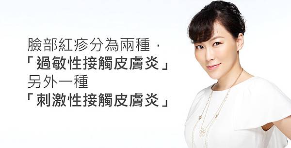 lu-TVBS-Rash-3 lu-TVBS-Rash-3