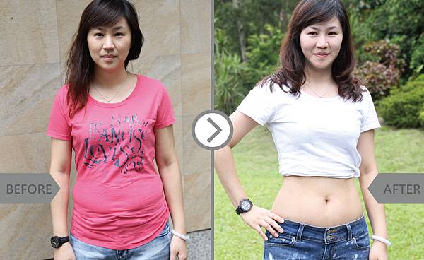 CoolSculpting-Tina-2 CoolSculpting-Tina-2