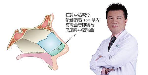 Chen-Hinet-bending-3