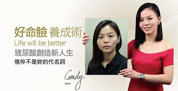 【玻尿酸】好命臉養成計畫 【玻尿酸】好命臉養成計畫