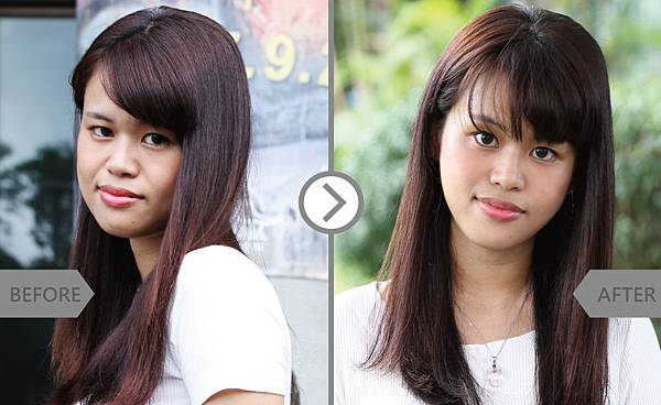 Hyaluronic-Tong-2 Hyaluronic-Tong-2