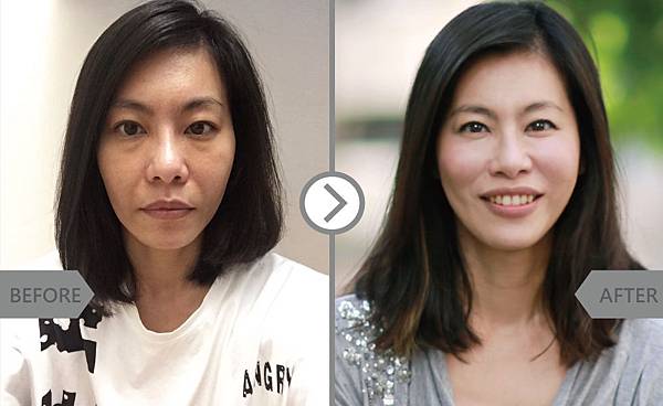 玻尿酸Hyaluronic-方玉婷jessica-2 玻尿酸Hyaluronic-方玉婷jessica-2