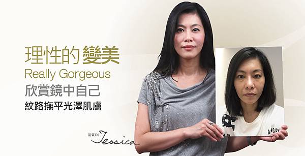 【玻尿酸】熟齡美肌計畫_Jessica 【玻尿酸】熟齡美肌計畫_Jessica