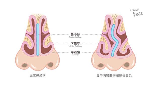 Chen-Doctor-nose-2