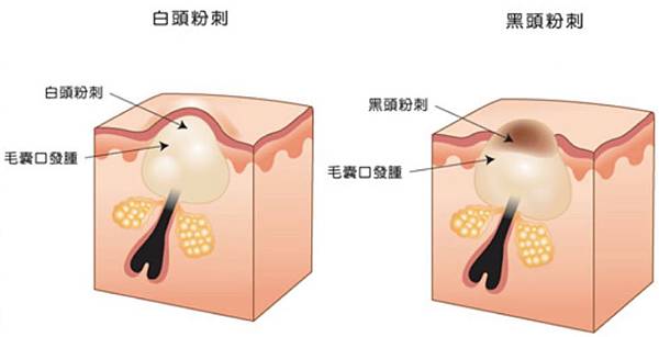 Chinyun-Doctor-skin-3 Chinyun-Doctor-skin-3