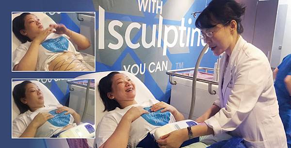 CoolSculpting-kiki-3