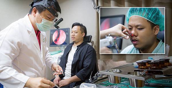 nose-Eric-2 nose-Eric-2