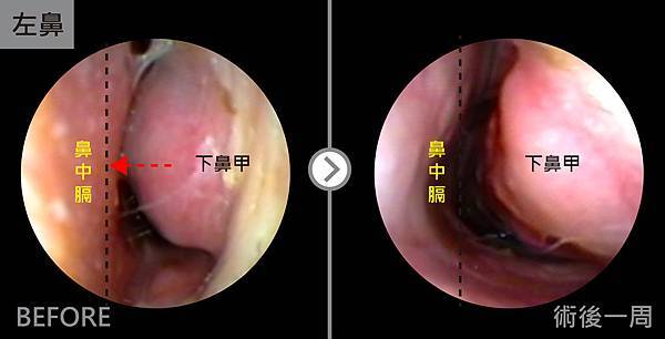nose-Eric-B-A-01 nose-Eric-B-A-01
