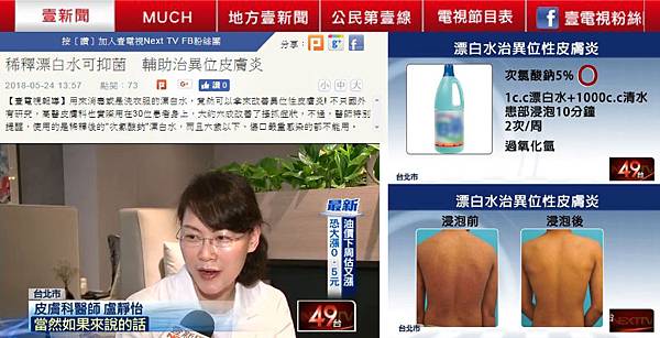 lu-Dandruff-2 lu-Dandruff-2