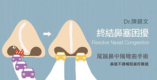 Chen-Doctor-Resolve Nasal Congestion2-1-01 Chen-Doctor-Resolve Nasal Congestion2-1-01