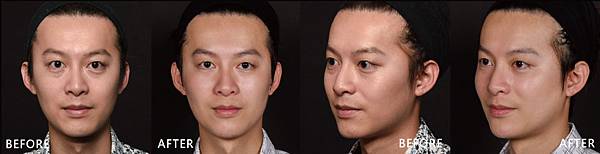 Hyaluronic-Bai-ba Hyaluronic-Bai-ba