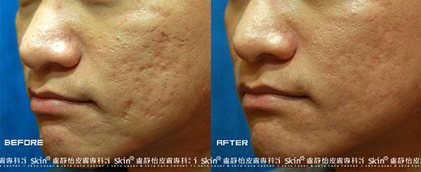 20180909-4 20180909-4