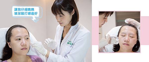 Hyaluronic-Eviei-4 Hyaluronic-Eviei-4