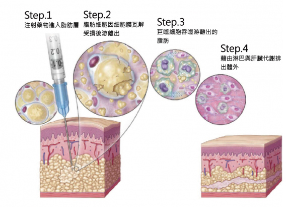 belkyra-cally-3 belkyra-cally-3