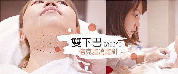 belkyra-cally-1 belkyra-cally-1