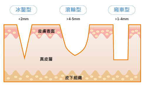 Fractional_Laser-Dong-3