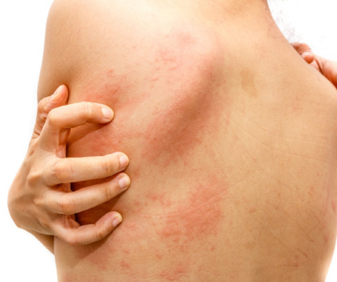 lu-Golden_Health_Spy-3 lu-Golden_Health_Spy-3