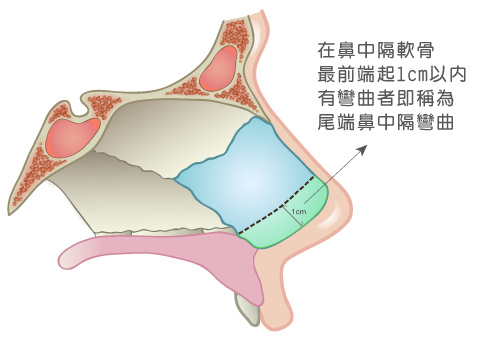 Chen-pixnet-Laser-tissue-3