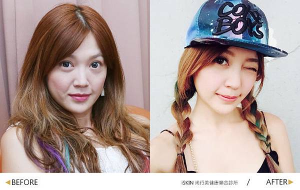 Replenisher-Ada-2-B-A Replenisher-Ada-2-B-A