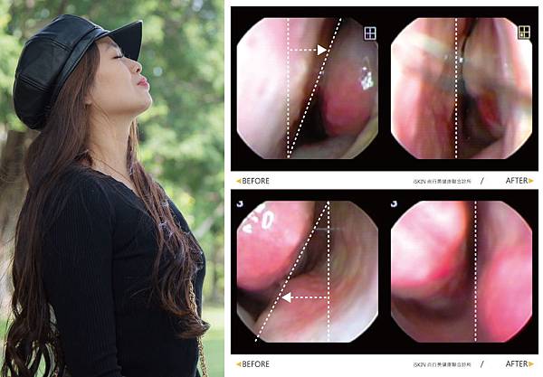 nose-Greta-4 nose-Greta-4