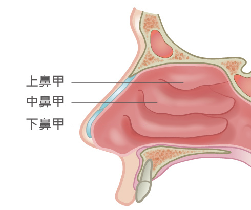nose-Tsai-4 nose-Tsai-4