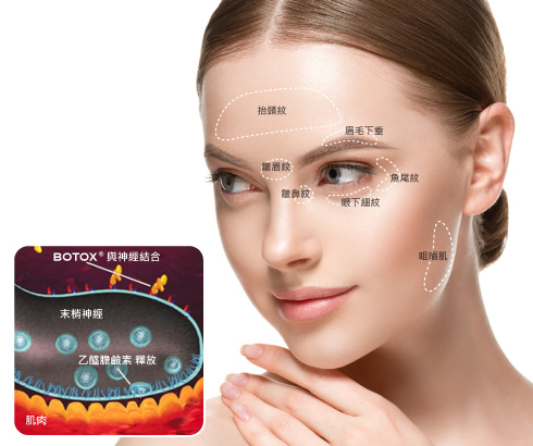 lu-yahoo-Botulinum-3 lu-yahoo-Botulinum-3