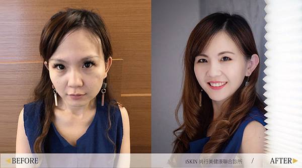 Hyaluronic-Kate-n5 Hyaluronic-Kate-n5