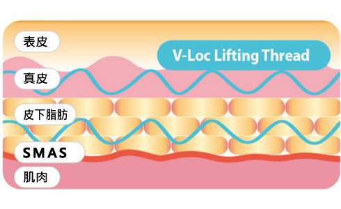 doublo200-Lynn-2 doublo200-Lynn-2